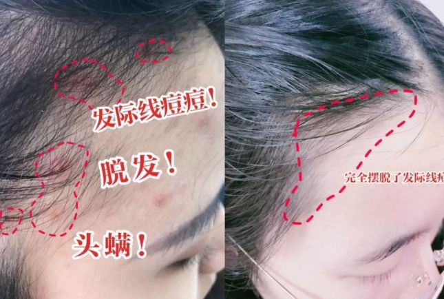 分钟让头发自然干！养出女明星绸缎发！开元棋牌app国产变态“抽水帽”几(图18)